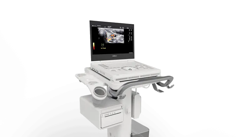Портативная ультразвуковая система GE HealthCare Logiq e