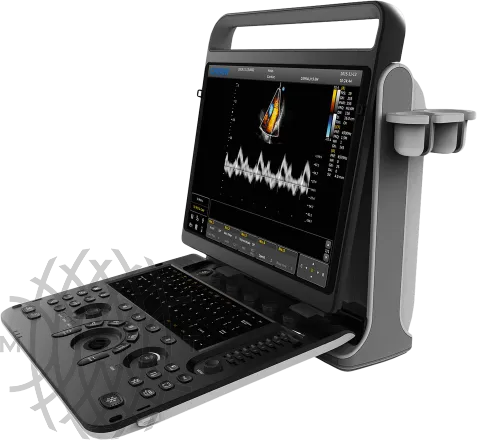 УЗИ аппарат Chison Sonotouch 60 OB портативный