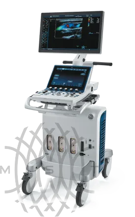 Ультразвуковая диагностическая система GE Vivid S60