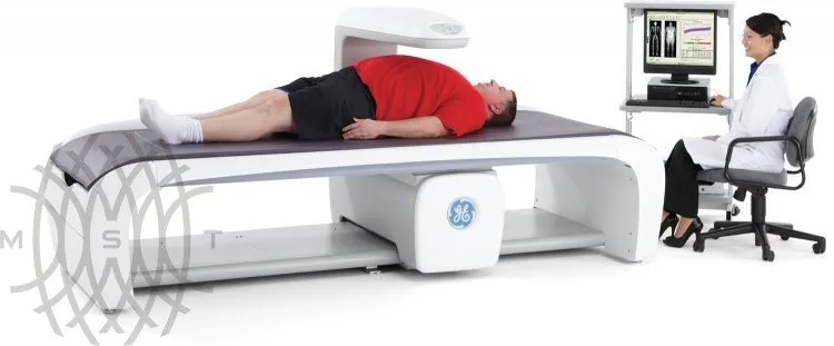 Рентгеновский денситометр GE Lunar iDXA