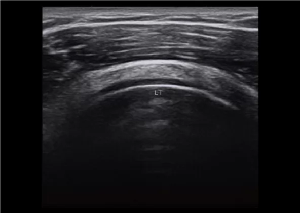 Клинические изображения УЗИ аппарат Chison CBit 4