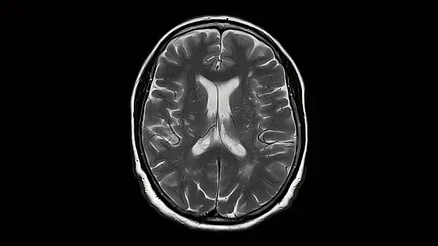 Клинические изображения МРТ аппарат Siemens Magnetom Sola 1,5T