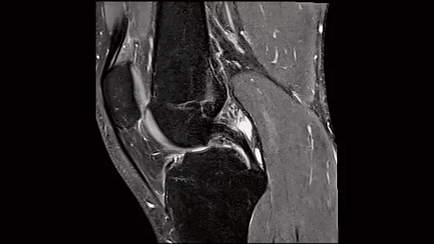 Клинические изображения МРТ аппарат Siemens Magnetom Sola 1,5T