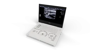 Портативный ультразвуковой аппарат GE Healthcare Logiq e