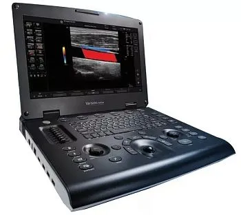 Портативный ультразвуковой аппарат GE Versana Active