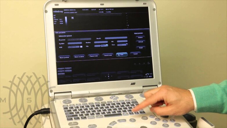 УЗИ аппарат Mindray M7 портативный