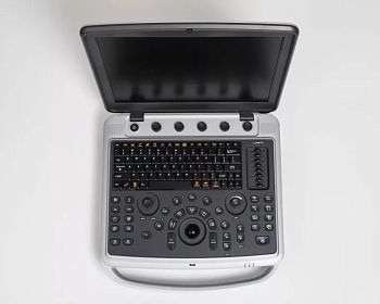 УЗИ аппарат Chison SonoBook 9 портативный